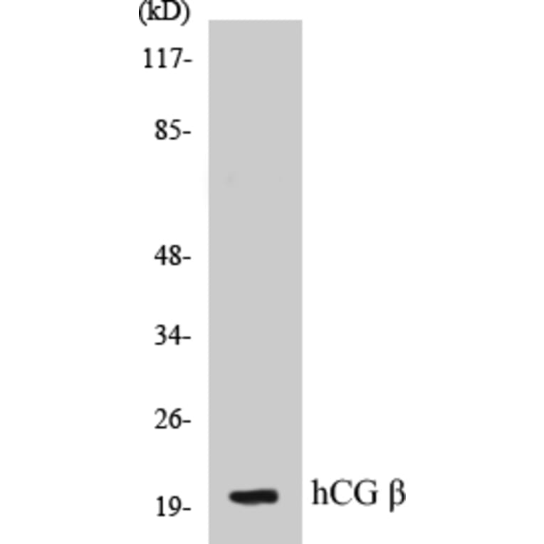Western Blot - hCG beta Cell Based ELISA Kit (CB5317) - Antibodies.com