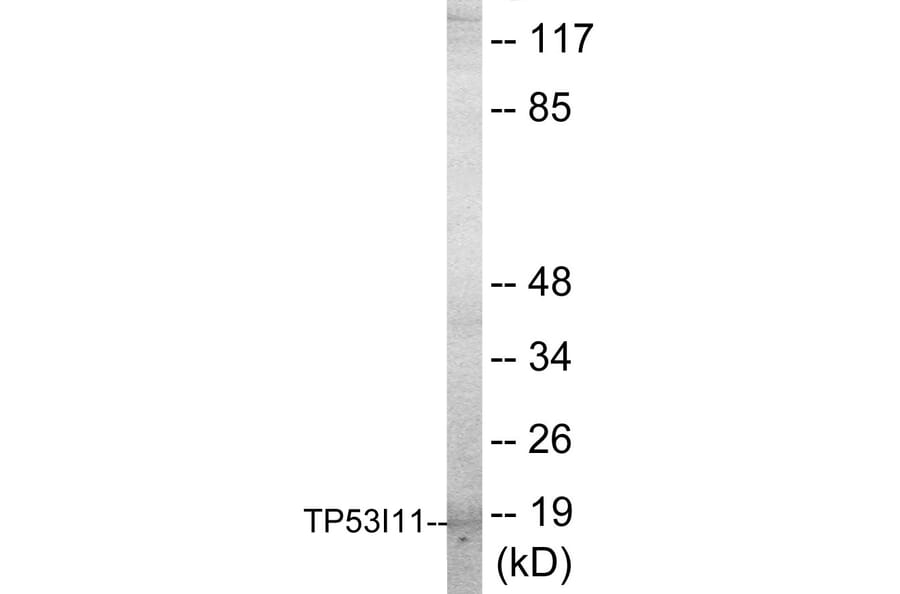 Western Blot - TP53I11 Cell Based ELISA Kit (CB5768) - Antibodies.com