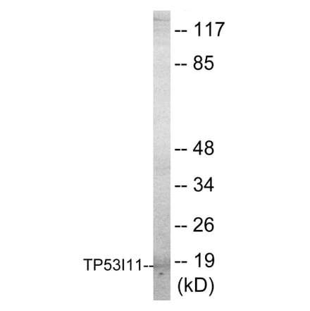 Western Blot - TP53I11 Cell Based ELISA Kit (CB5768) - Antibodies.com