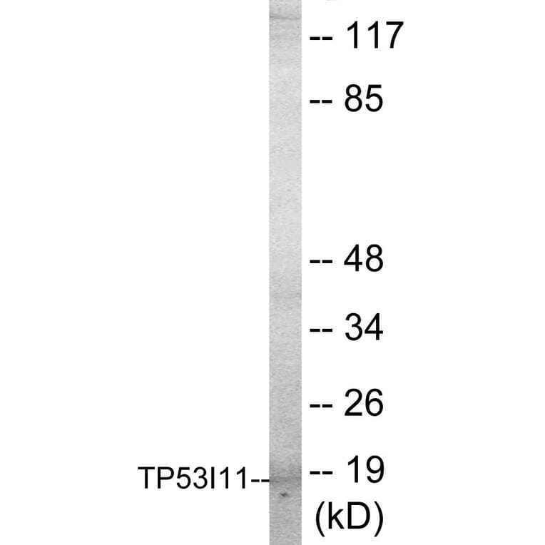 Western Blot - TP53I11 Cell Based ELISA Kit (CB5768) - Antibodies.com