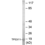 Western Blot - TP53I11 Cell Based ELISA Kit (CB5768) - Antibodies.com