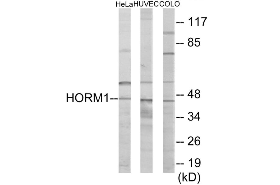 Western Blot - HORMAD1 Cell Based ELISA Kit (CB6073) - Antibodies.com