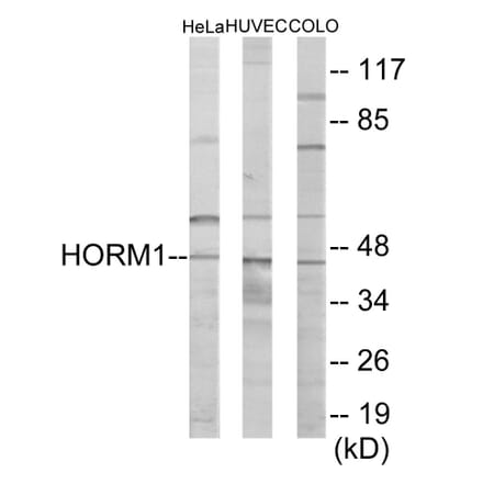 Western Blot - HORMAD1 Cell Based ELISA Kit (CB6073) - Antibodies.com