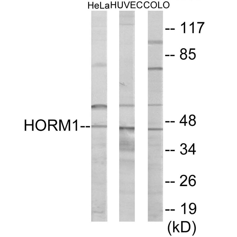 Western Blot - HORMAD1 Cell Based ELISA Kit (CB6073) - Antibodies.com
