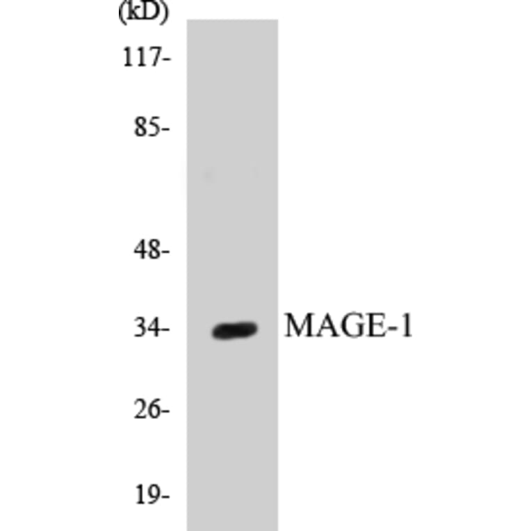Western Blot - MAGE-1 Cell Based ELISA Kit (CB5420) - Antibodies.com