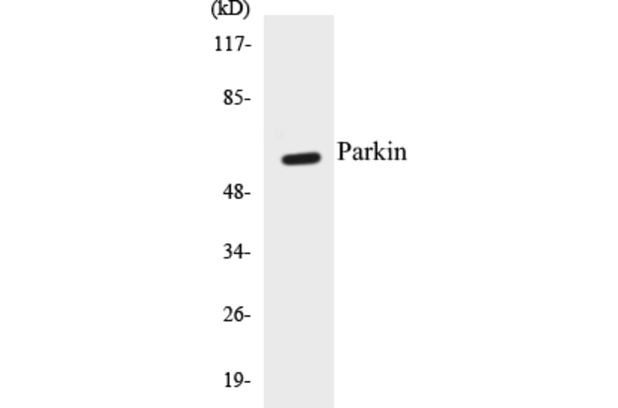 Western Blot - Parkin Cell Based ELISA Kit (CB5534) - Antibodies.com