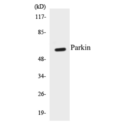 Western Blot - Parkin Cell Based ELISA Kit (CB5534) - Antibodies.com