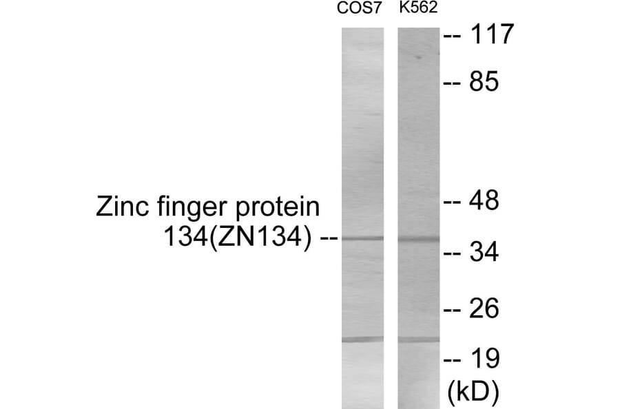 Western Blot - ZNF134 Cell Based ELISA Kit (CB5916) - Antibodies.com