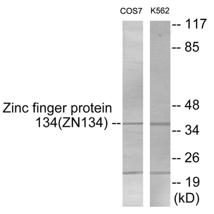 Western Blot - ZNF134 Cell Based ELISA Kit (CB5916) - Antibodies.com