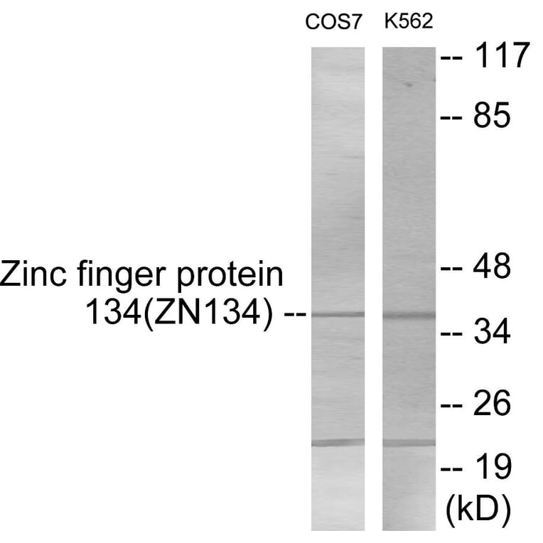 Western Blot - ZNF134 Cell Based ELISA Kit (CB5916) - Antibodies.com