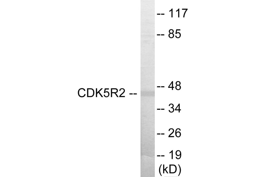 Western Blot - CDK5R2 Cell Based ELISA Kit (CB5985) - Antibodies.com