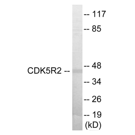 Western Blot - CDK5R2 Cell Based ELISA Kit (CB5985) - Antibodies.com