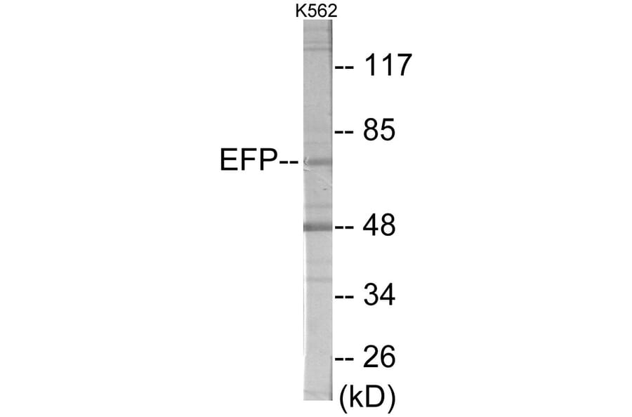 Western Blot - ZNF147 Cell Based ELISA Kit (CB6001) - Antibodies.com