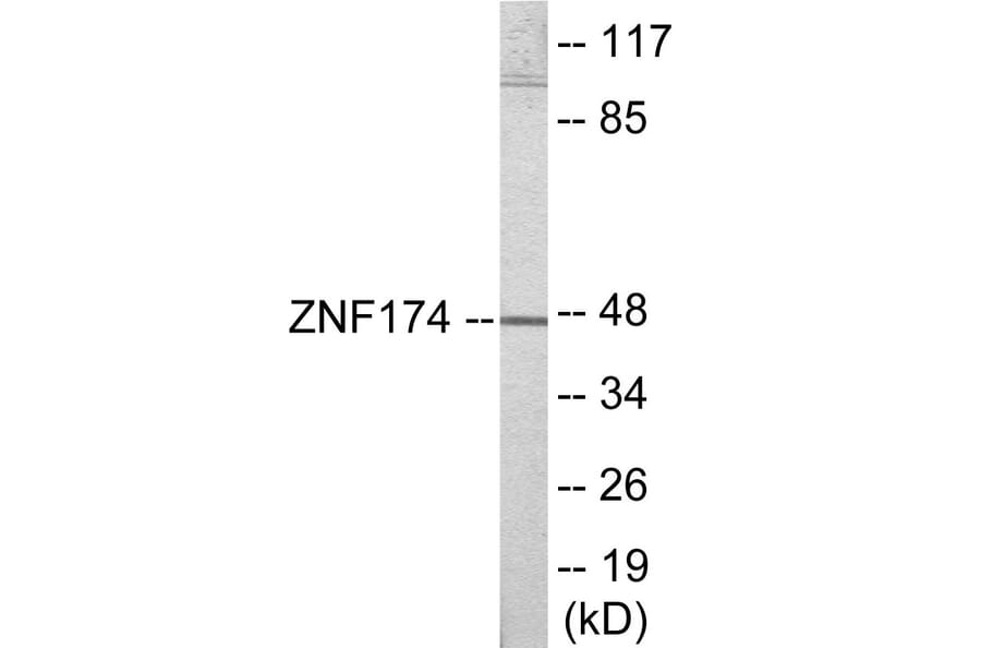 Western Blot - ZNF174 Cell Based ELISA Kit (CB6028) - Antibodies.com
