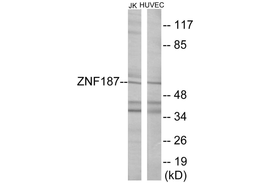 Western Blot - ZNF187 Cell Based ELISA Kit (CB6040) - Antibodies.com