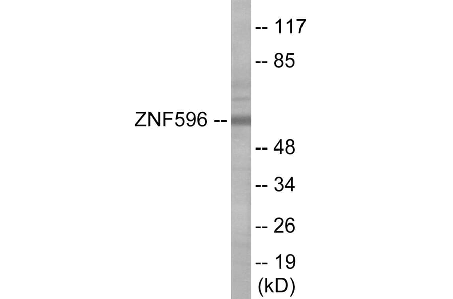 Western Blot - ZNF596 Cell Based ELISA Kit (CB6089) - Antibodies.com