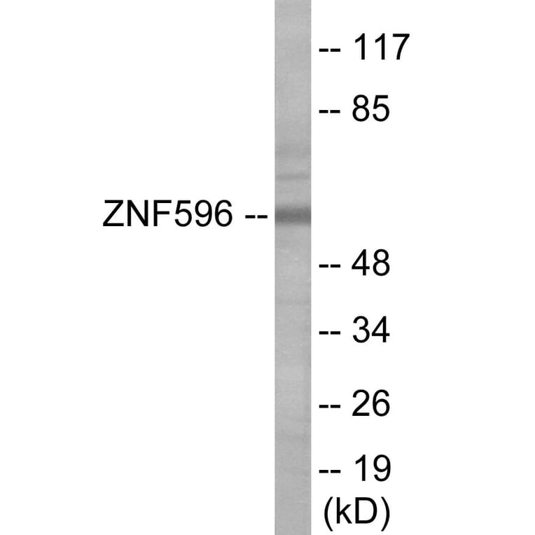 Western Blot - ZNF596 Cell Based ELISA Kit (CB6089) - Antibodies.com