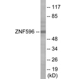 Western Blot - ZNF596 Cell Based ELISA Kit (CB6089) - Antibodies.com