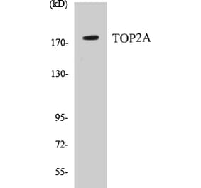Western Blot - TOP2A Cell Based ELISA Kit (CB5698) - Antibodies.com