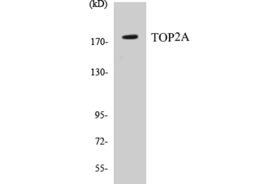 Western Blot - TOP2A Cell Based ELISA Kit (CB5698) - Antibodies.com