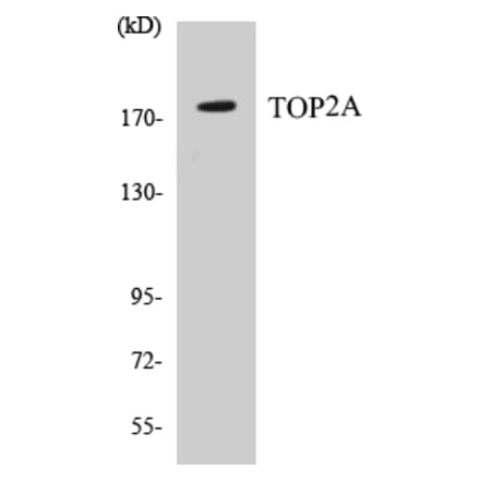 Western Blot - TOP2A Cell Based ELISA Kit (CB5698) - Antibodies.com