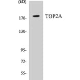 Western Blot - TOP2A Cell Based ELISA Kit (CB5698) - Antibodies.com