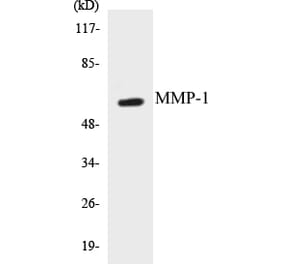 Western Blot - MMP-1 Cell Based ELISA Kit (CB5455) - Antibodies.com