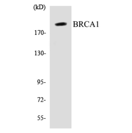 Western Blot - BRCA1 Cell Based ELISA Kit (CB5079) - Antibodies.com
