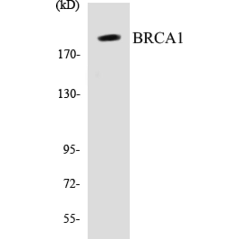 Western Blot - BRCA1 Cell Based ELISA Kit (CB5079) - Antibodies.com