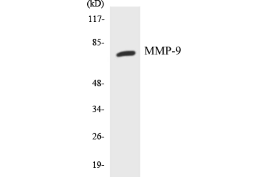Western Blot - MMP-9 Cell Based ELISA Kit (CB5467) - Antibodies.com