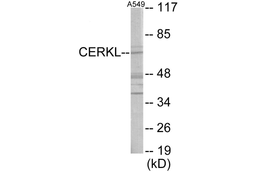 Western Blot - CERKL Cell Based ELISA Kit (CB6049) - Antibodies.com