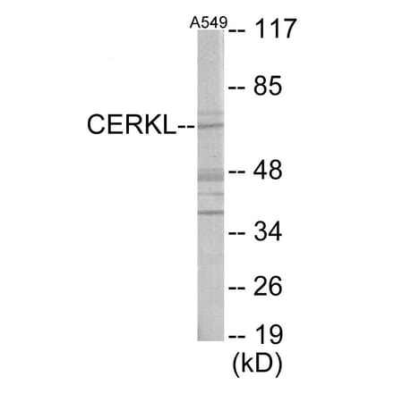 Western Blot - CERKL Cell Based ELISA Kit (CB6049) - Antibodies.com