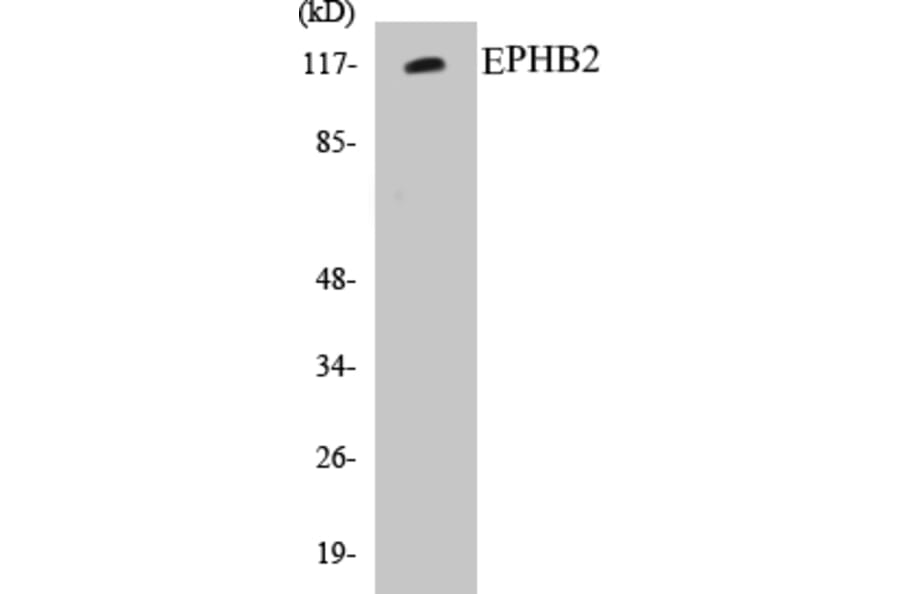 Western Blot - EPHB2 Cell Based ELISA Kit (CB5240) - Antibodies.com