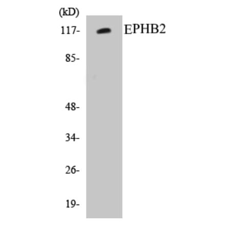 Western Blot - EPHB2 Cell Based ELISA Kit (CB5240) - Antibodies.com