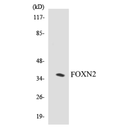 Western Blot - FOXN2 Cell Based ELISA Kit (CB5274) - Antibodies.com