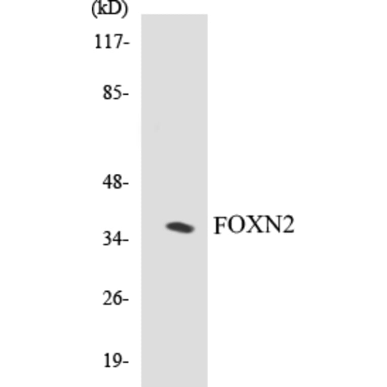 Western Blot - FOXN2 Cell Based ELISA Kit (CB5274) - Antibodies.com