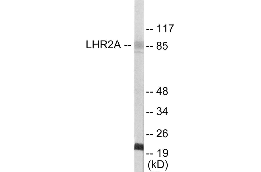 Western Blot - LHR2A Cell Based ELISA Kit (CB5765) - Antibodies.com