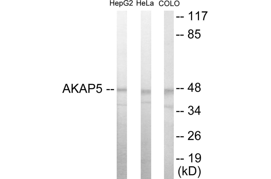 Western Blot - AKAP5 Cell Based ELISA Kit (CB5862) - Antibodies.com