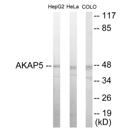Western Blot - AKAP5 Cell Based ELISA Kit (CB5862) - Antibodies.com