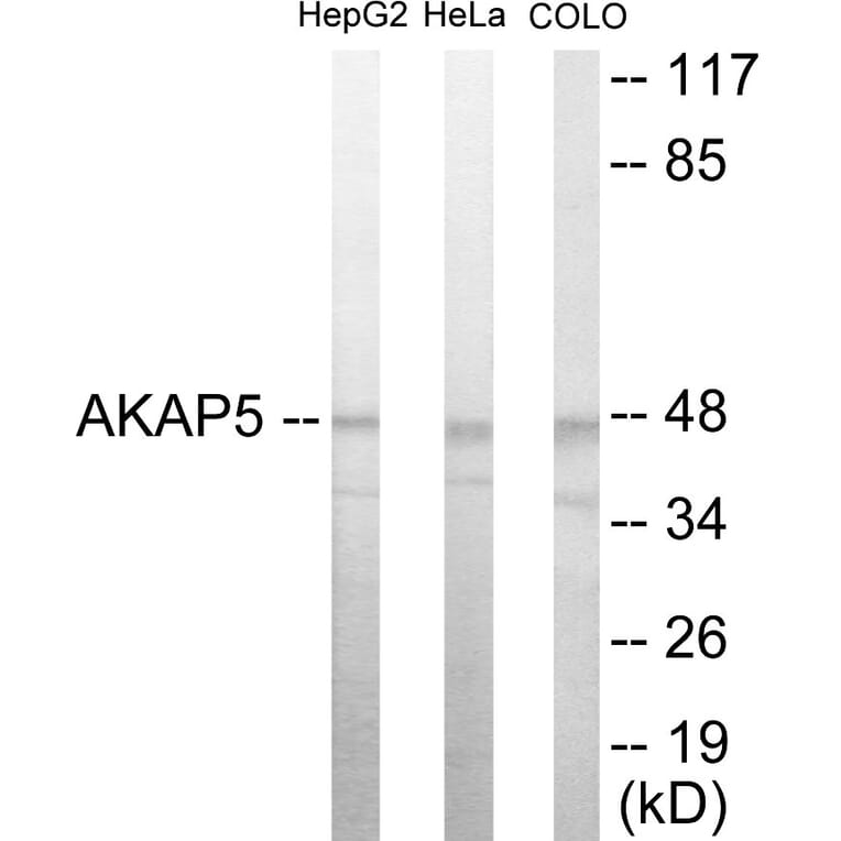Western Blot - AKAP5 Cell Based ELISA Kit (CB5862) - Antibodies.com