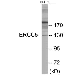 Western Blot - ERCC5 Cell Based ELISA Kit (CB5870) - Antibodies.com