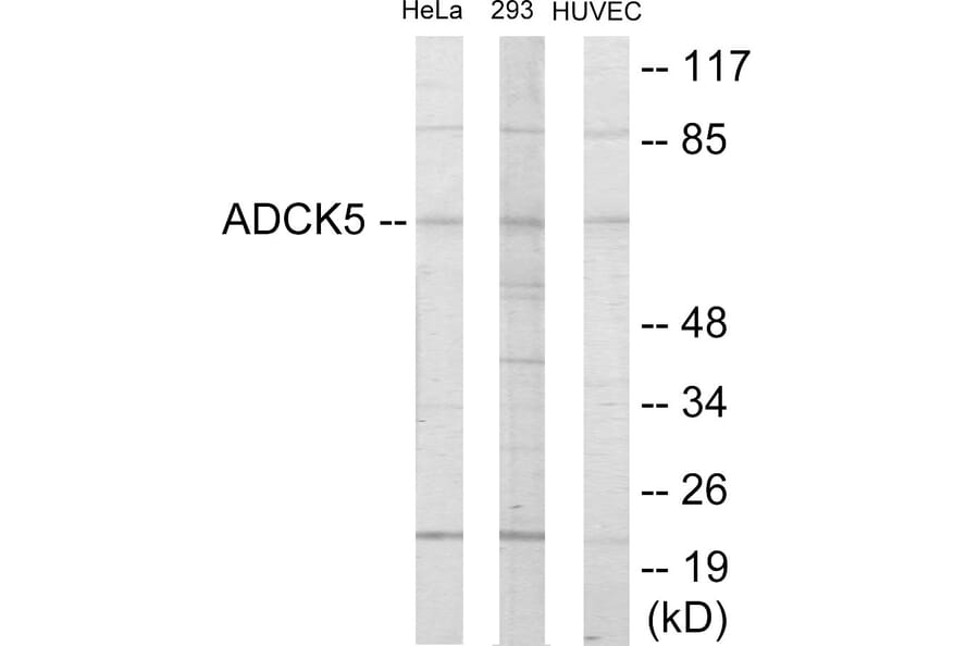 Western Blot - ADCK5 Cell Based ELISA Kit (CB6048) - Antibodies.com