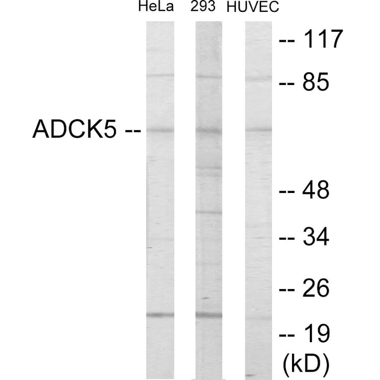 Western Blot - ADCK5 Cell Based ELISA Kit (CB6048) - Antibodies.com