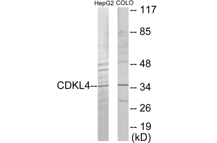 Western Blot - CDKL4 Cell Based ELISA Kit (CB6055) - Antibodies.com