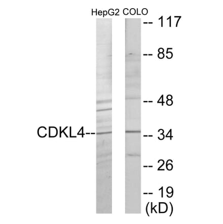Western Blot - CDKL4 Cell Based ELISA Kit (CB6055) - Antibodies.com