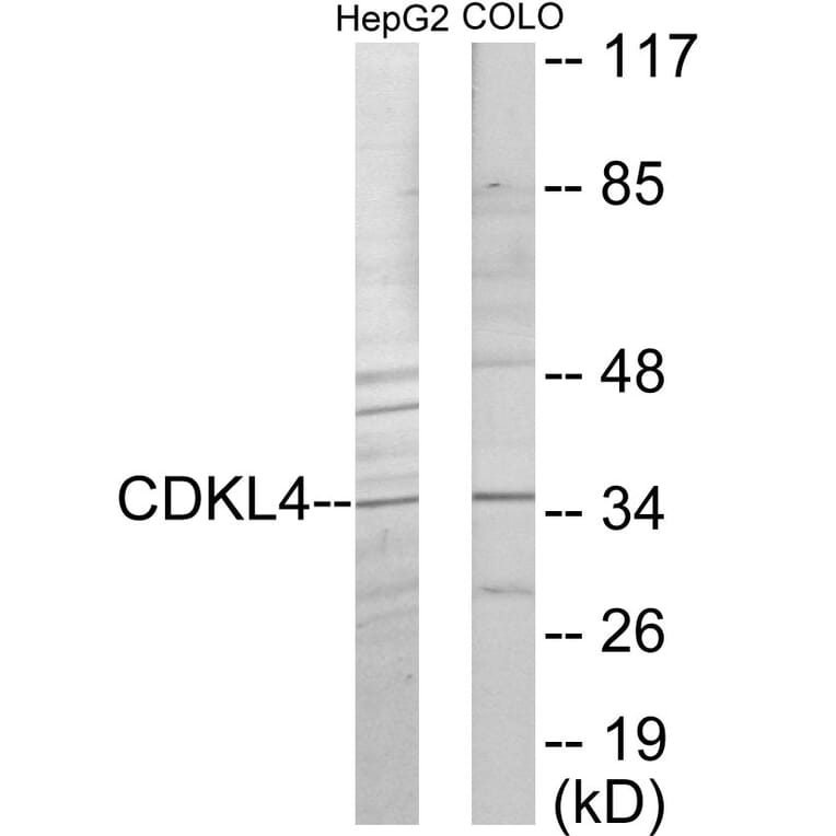 Western Blot - CDKL4 Cell Based ELISA Kit (CB6055) - Antibodies.com