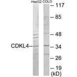 Western Blot - CDKL4 Cell Based ELISA Kit (CB6055) - Antibodies.com