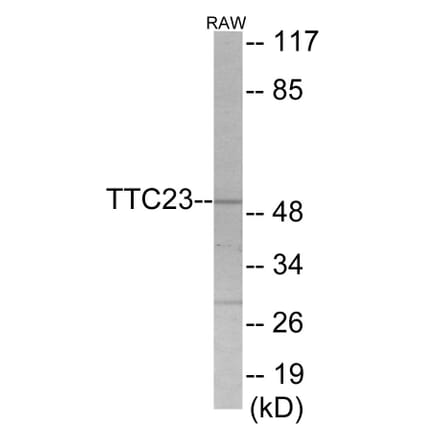 Western Blot - TTC23 Cell Based ELISA Kit (CB6058) - Antibodies.com