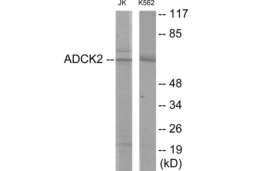 Western Blot - ADCK2 Cell Based ELISA Kit (CB6069) - Antibodies.com
