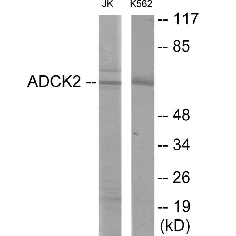 Western Blot - ADCK2 Cell Based ELISA Kit (CB6069) - Antibodies.com